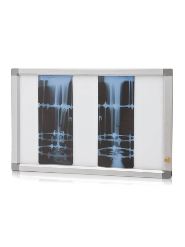 Негатоскоп общего назначения Armed 2-кадровый флуоресцентный