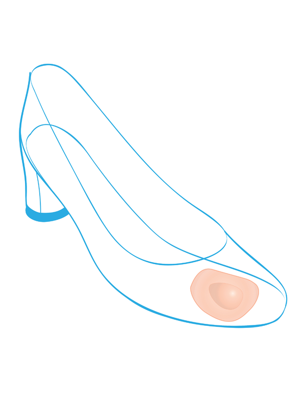 Подушечки ортопедические для стоп - "Крейт"С-121